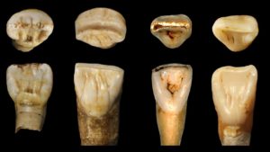 الأسنان على اليسار من اللقى التي اكتشف في الصين في حين أن الأسنان على اليمين تعود لإنسان حديث